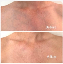 Load image into Gallery viewer, Trudermal Glow LED Neck, Décolletage And Hands Mask
